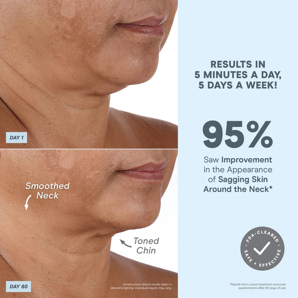 Smart Petite Microcurrent Facial Toning Kit