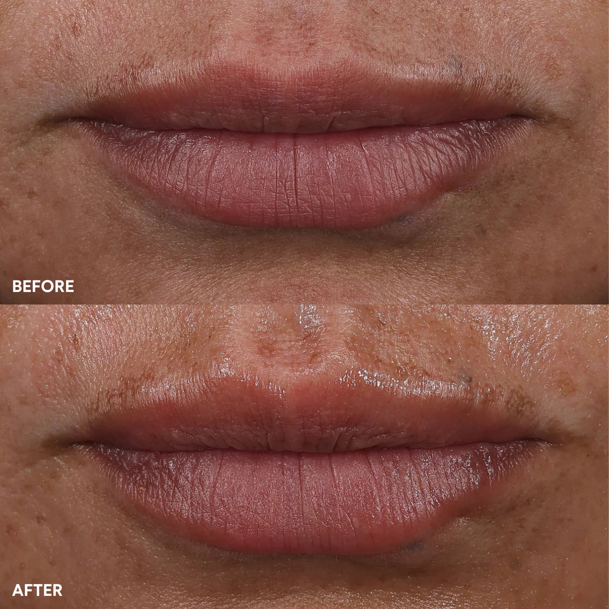 The Power Move Targeted Treatment Bundle