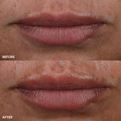 The Power Move Targeted Treatment Bundle