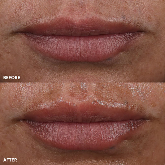 The Power Move Targeted Treatment Bundle